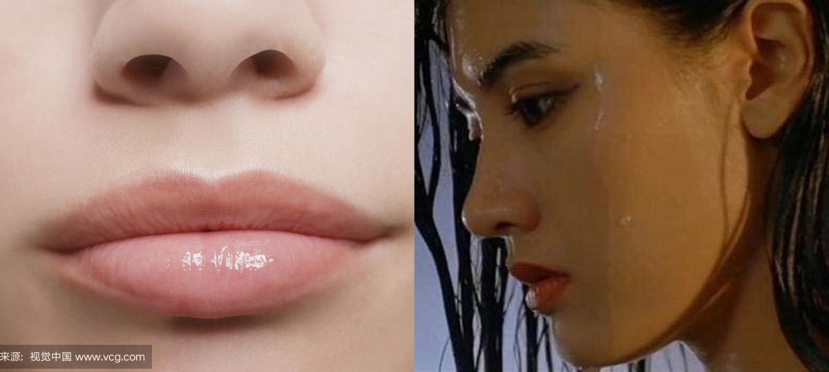 唇裂术后显示红唇缺失,唇裂手术后红唇一侧偏厚正常吗