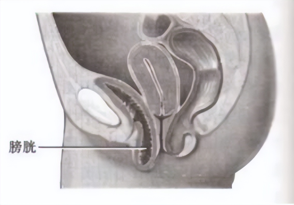 怎么办？下面“长”出了奇怪的东西