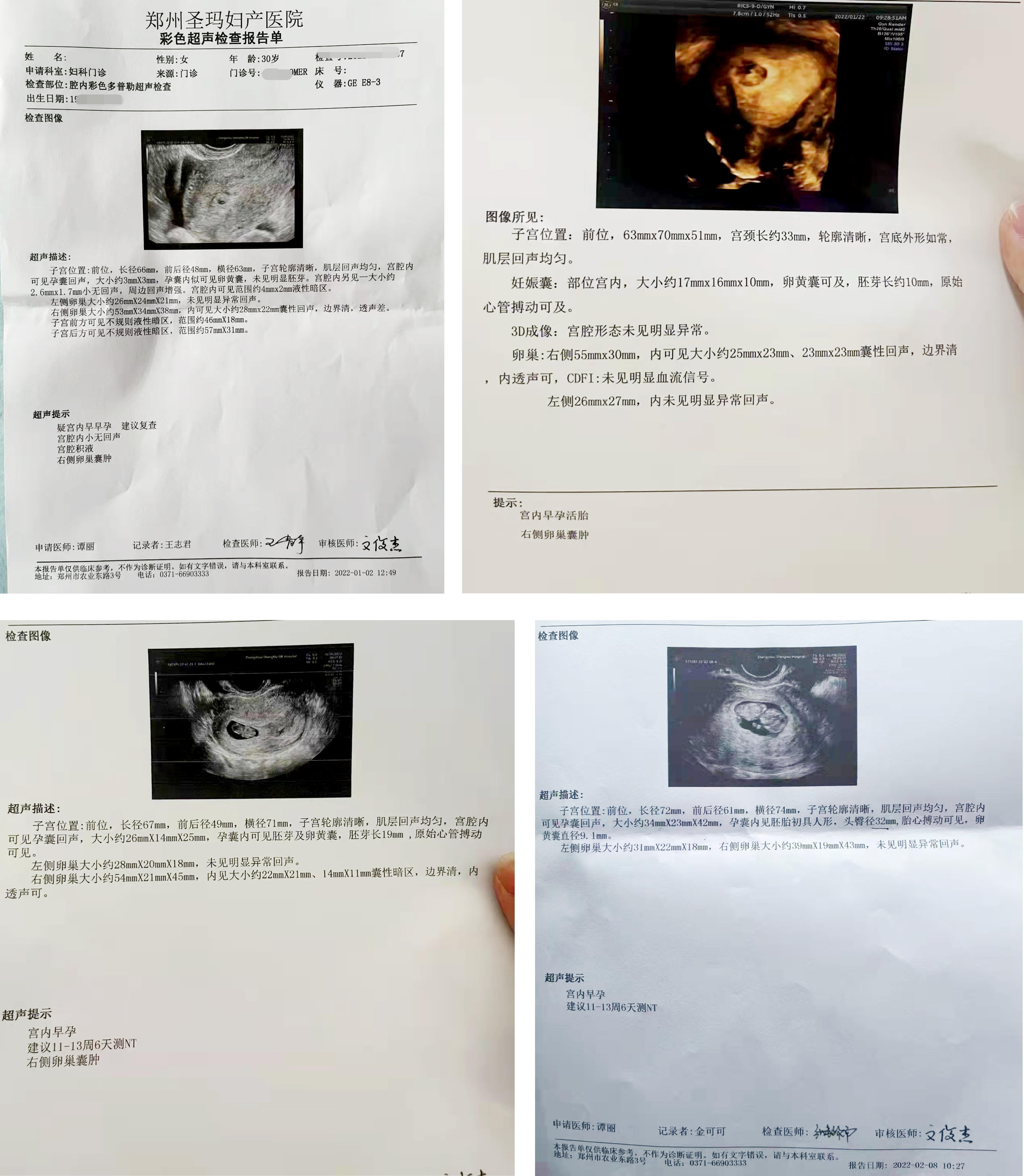 移植后hcg不翻倍可以打绒促吗,移植后hcg不翻倍是不是就保不住了