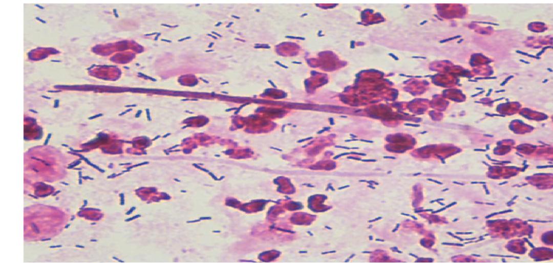 派特灵生物,派特灵生物讲解