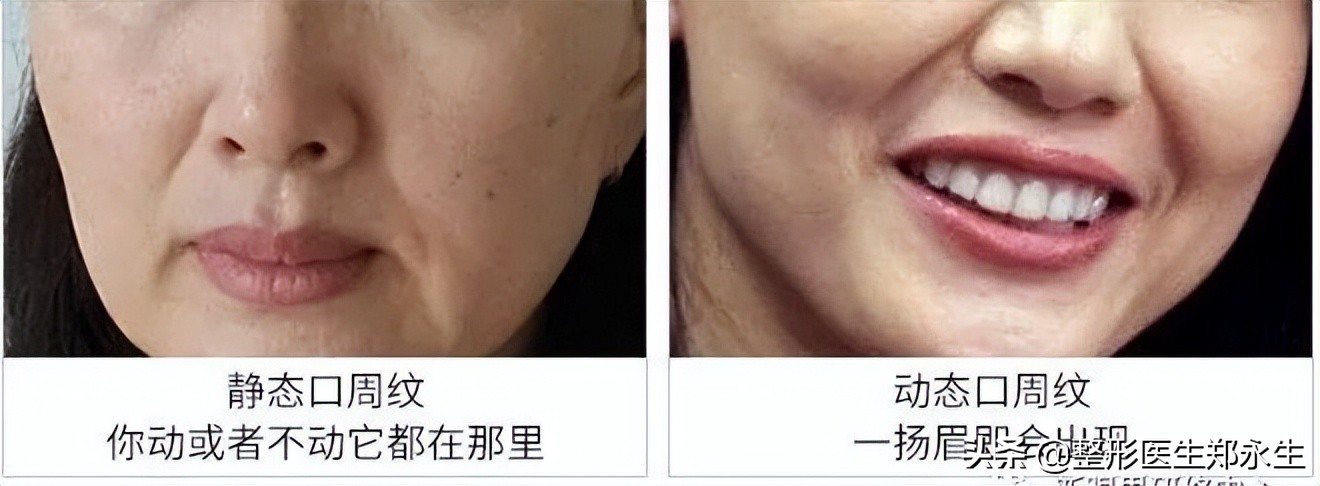 嘴唇干裂起皮用什么样的口红,干裂提亮口红