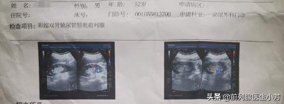 6年的前列腺炎一个半疗程治好，怎么做到的？