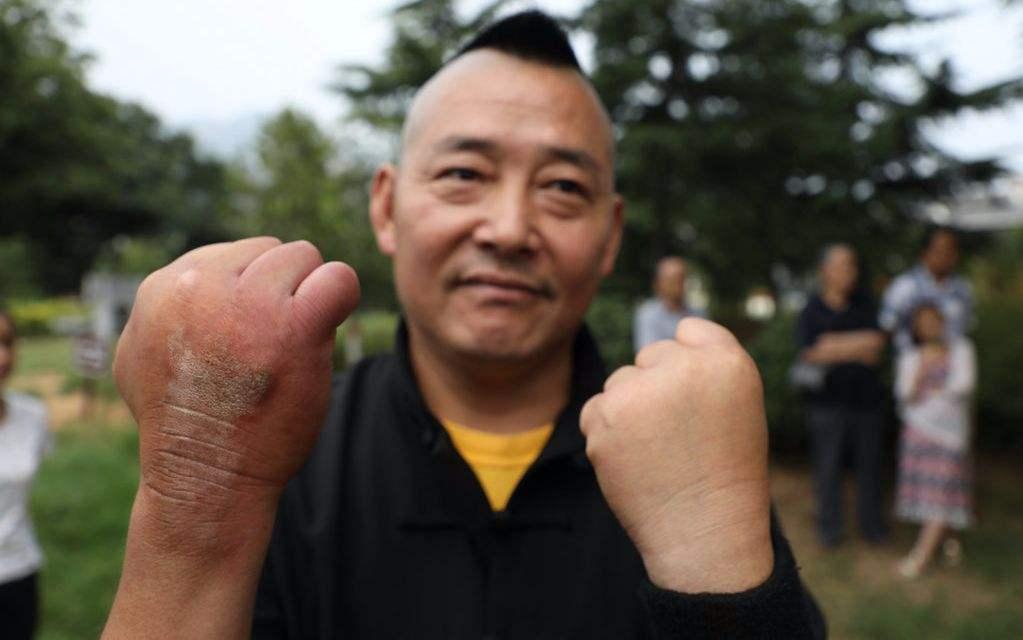 骨骼一碰就碎是什么病,骨骼一碰就碎