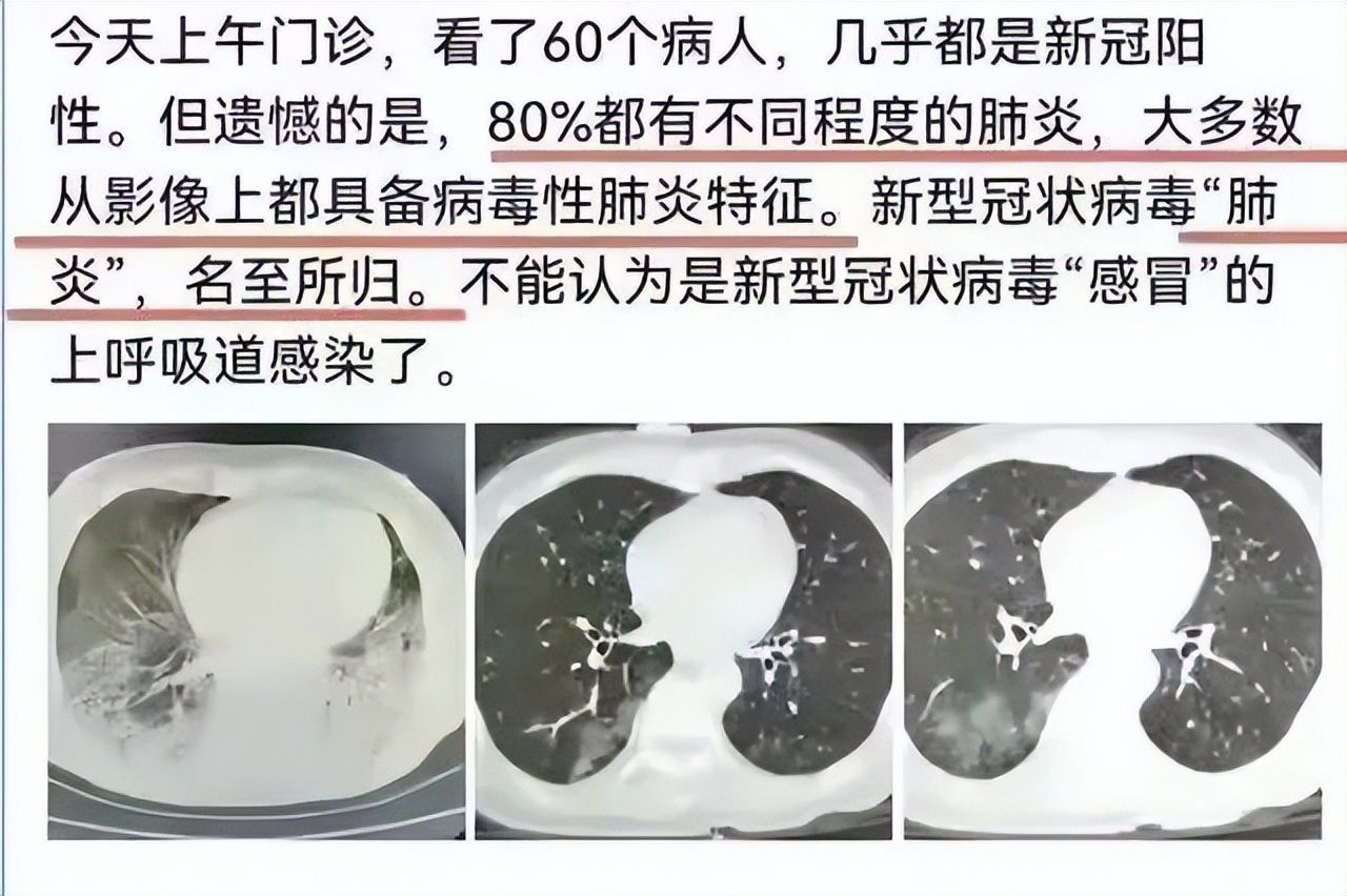 疫情全面放开后，为何这么多人大骂钟南山？他到底做错了什么？