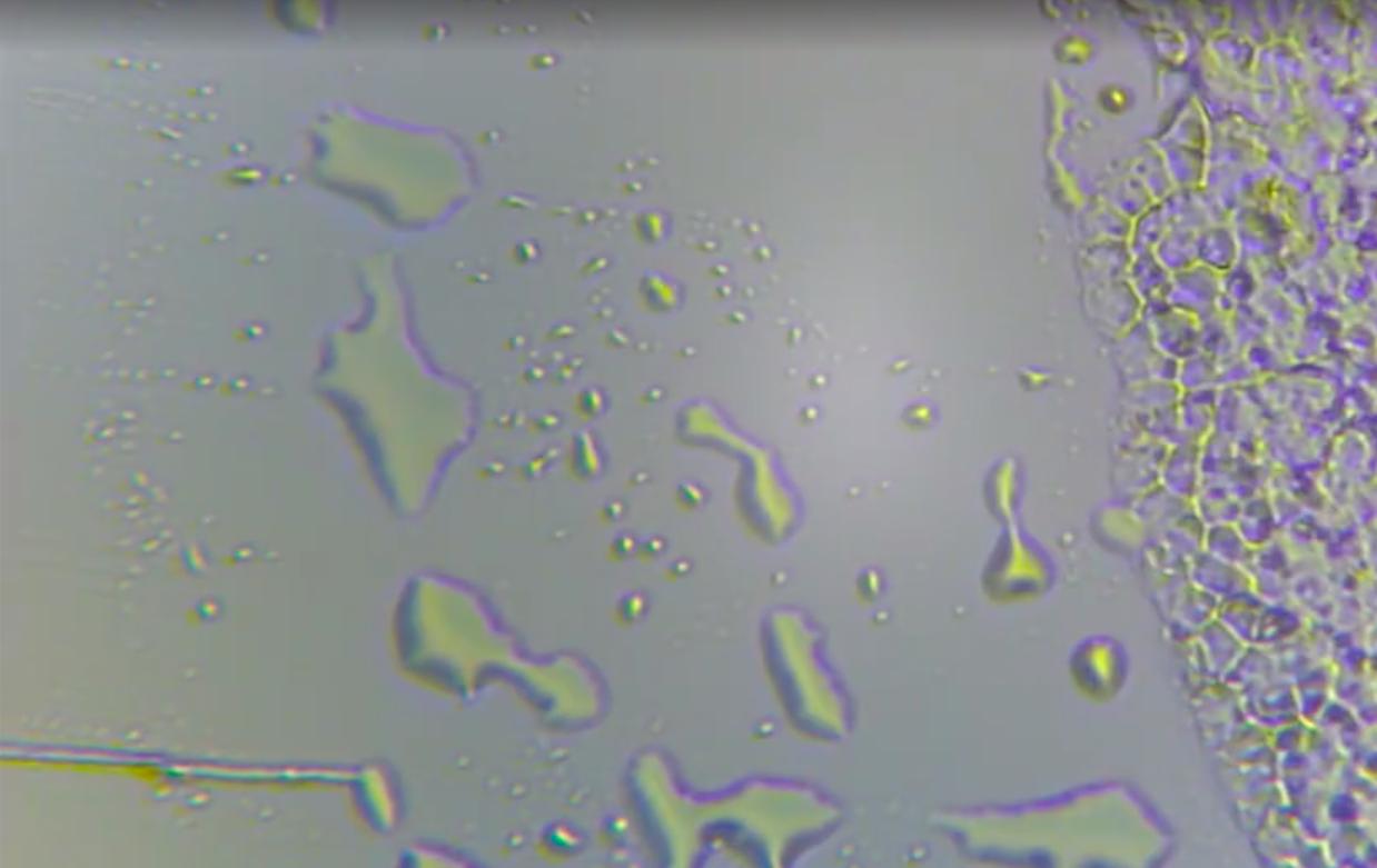 黑头白头在显微镜下怎么样,黑头可以挤出来是什么样子