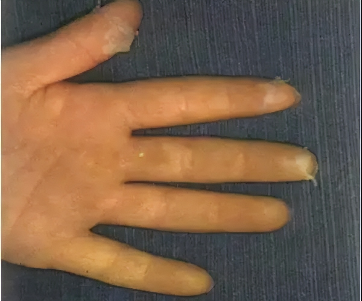 小孩的舌头出现小红点点,小儿舌头的各种症状如何解决