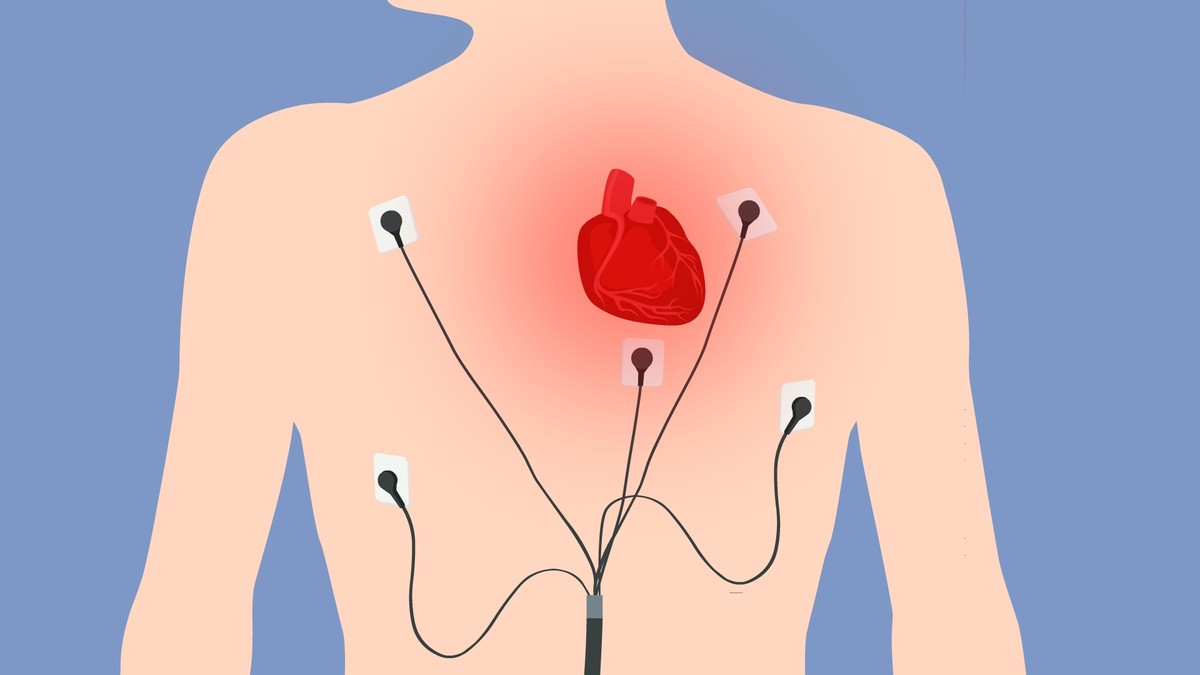 儿童心肌炎多长时间可以恢复,爆发式心肌炎心脏扩大能恢复吗