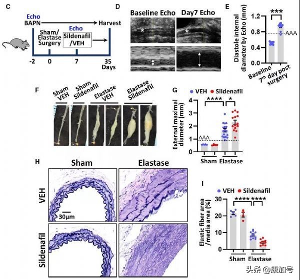 伟哥的副作用和危害高血压,伟哥会伤害主动脉血管吗