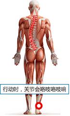 强直性脊柱炎的预防方法都有哪些,强直性脊柱炎自我保健