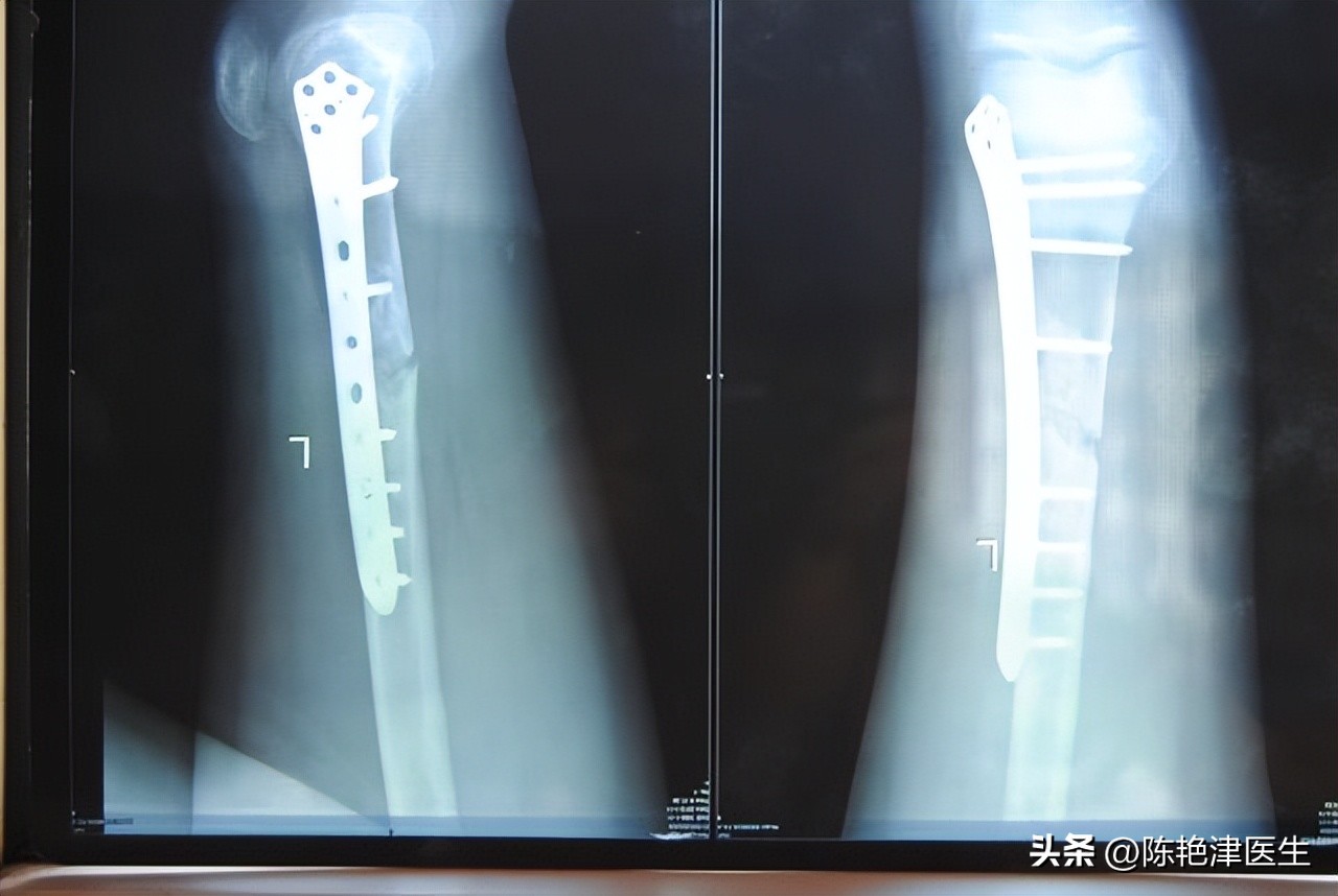 晚上喝牛奶和早上喝牛奶哪个更好,长期夜间喝牛奶会不会有什么危害