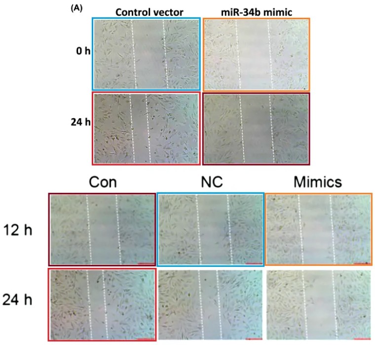 组图复制？浙江省桐庐县第一人民医院的论文被质疑抄袭