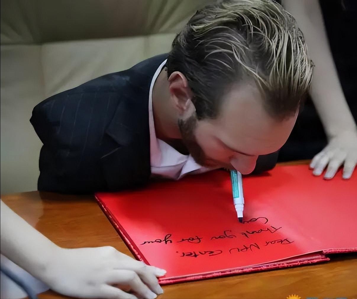 一出生就没有了四肢,一出生就失去一条腿