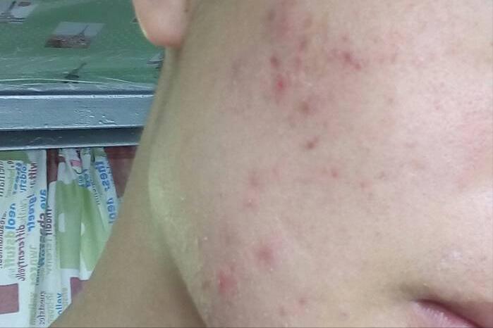 雄性激素越高越好吗?不一定,可能会造成4种后果,如何调理?