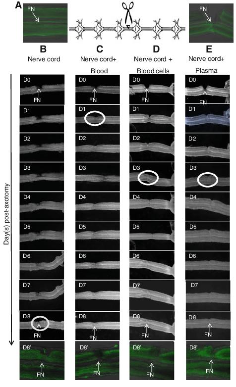 隐私部位也可能寄生！蚂蟥不小心吃下肚，会在人体内长期存活吗？