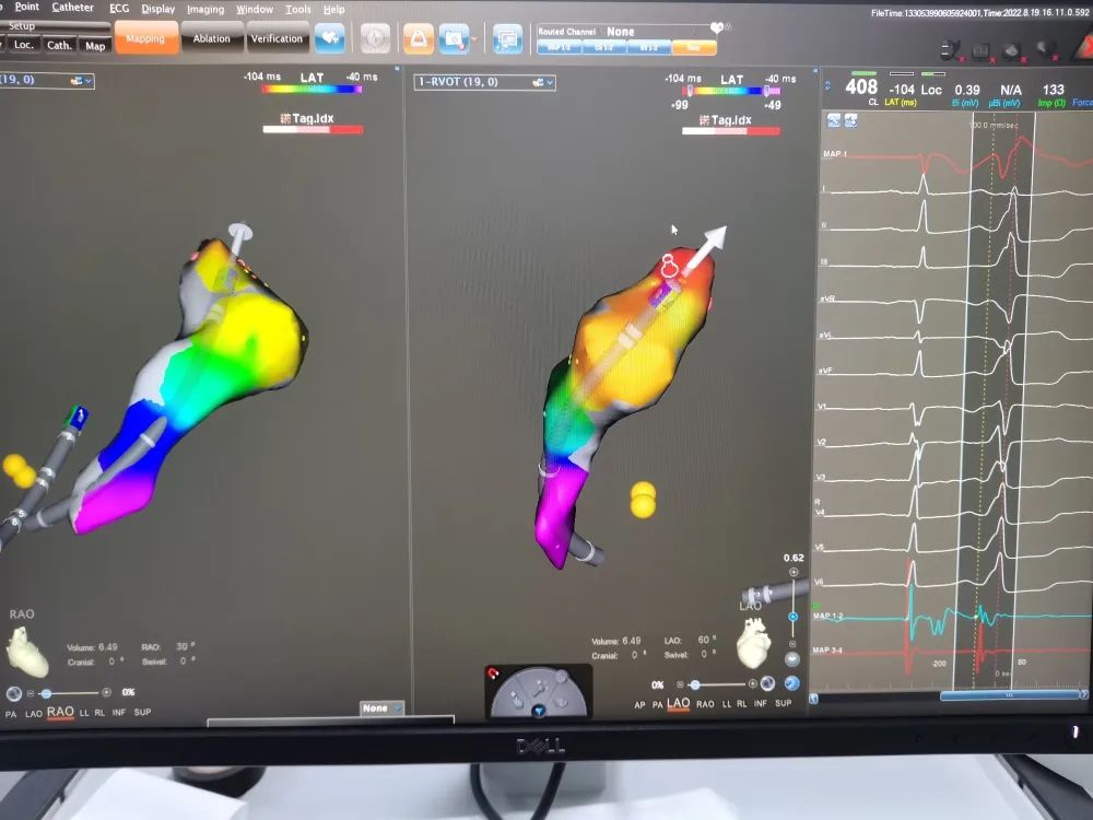 点燃心灵的火焰,点燃爱心的火焰