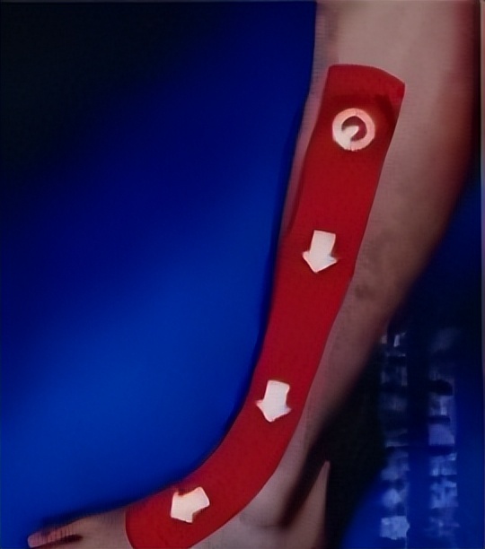 偏瘫肘关节伸不直怎样康复,偏瘫膝过伸走路不能屈膝怎么办