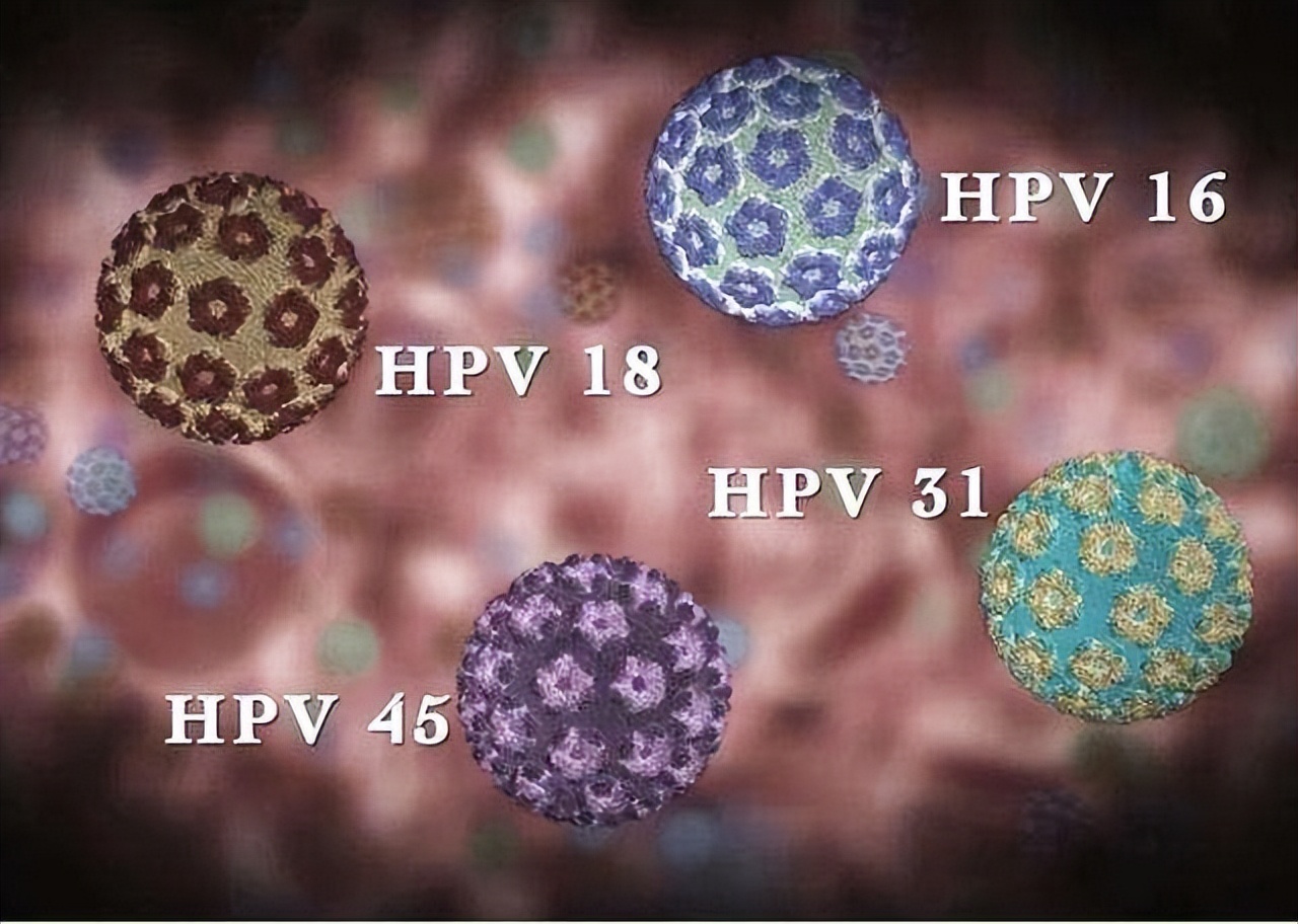 46岁大姐棋牌室感染HPV，“肉芽”长满脖子，劝告：四件事要少做