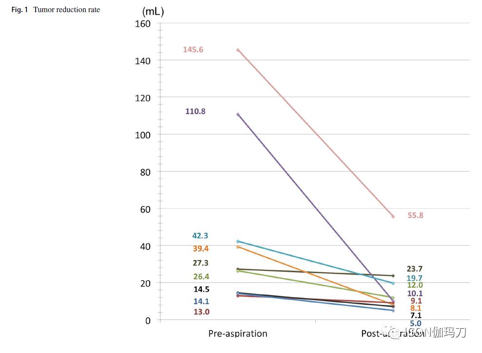 囊肿抽吸后分割伽玛刀放射外科治疗大的囊性脑转移瘤