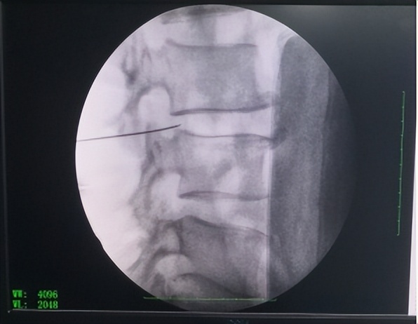 庆城县岐伯中医医院,甘肃庆阳市庆城县岐伯中医医院