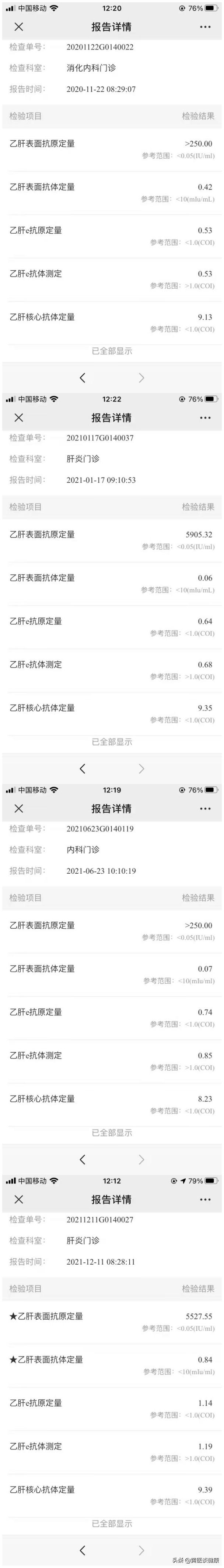 乙肝小三阳门静脉增宽16能活多久,抗病毒1年反而肝纤维化严重了