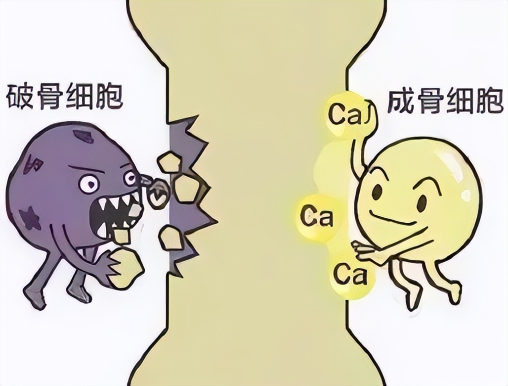 儿童骨密度检测中bmi正常范围,34岁骨密度检测说骨质疏松怎么办