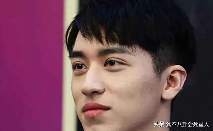 景甜悲伤蛙双眼皮照片,明星割双眼皮前后对比图