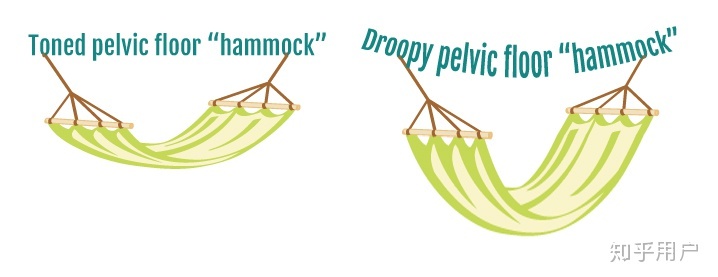 更年期女性怎样盆底康复,更年期盆底疾病有必要看吗
