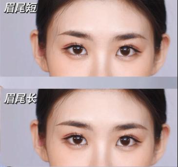 眉毛不对称怎么办可以整容吗,脸圆眉毛淡怎么修剪