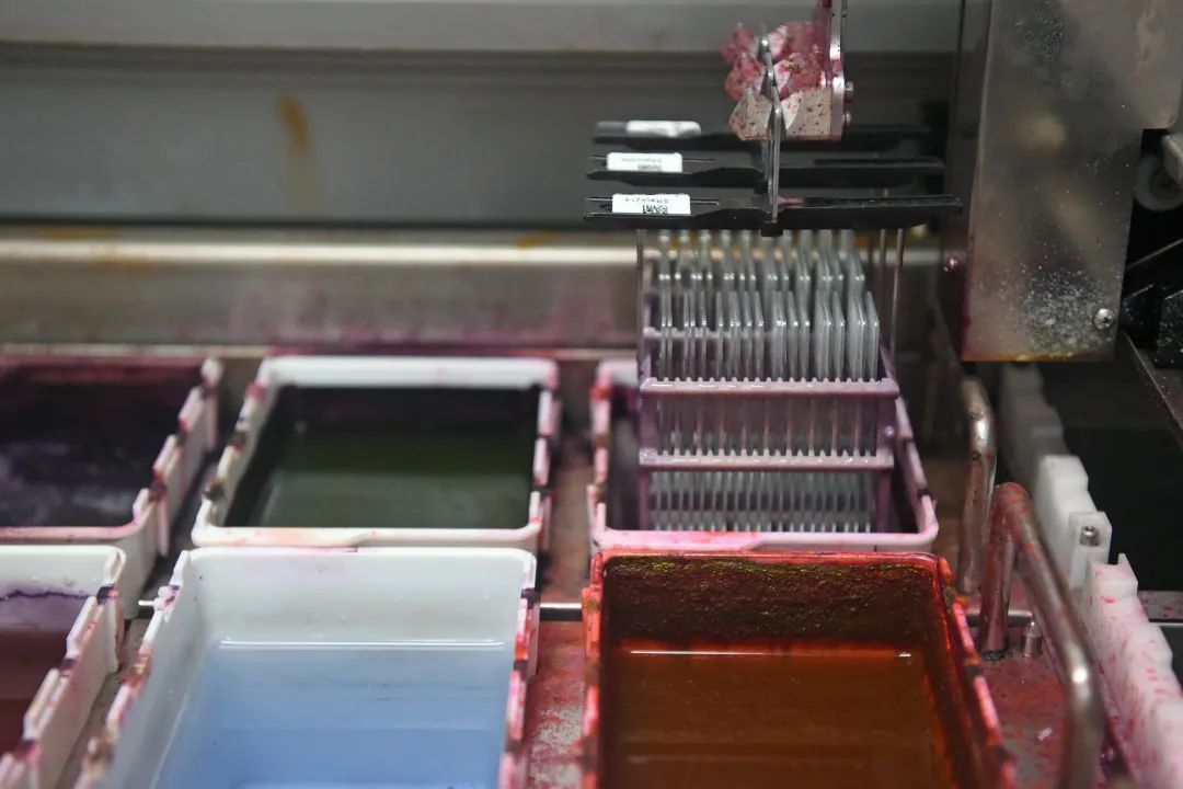 医生说病理报告有点小问题,病理报告没出来好害怕啊