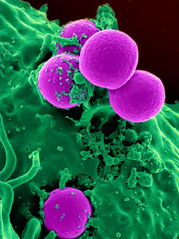 人体抵御细菌感染的第一道防线,人体卫士大战细菌