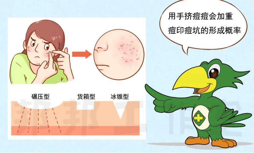 痘印全攻略——不同类型的治疗选择