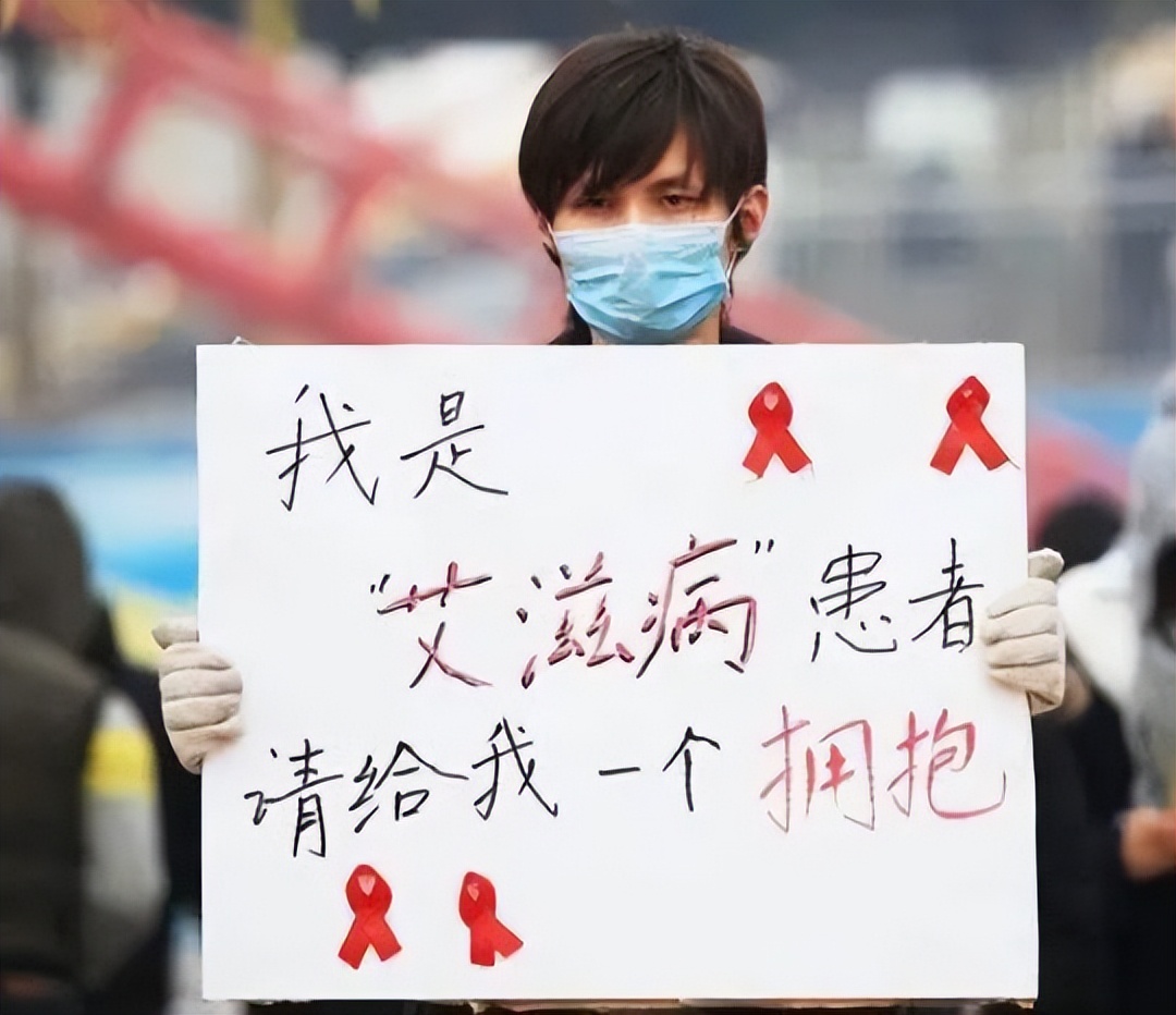 不要错把艾滋病当皮肤病,不要错把艾滋当成皮肤病