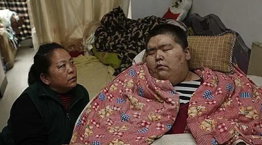 一个小伙胸口长了很多瘤子,河北500斤小伙