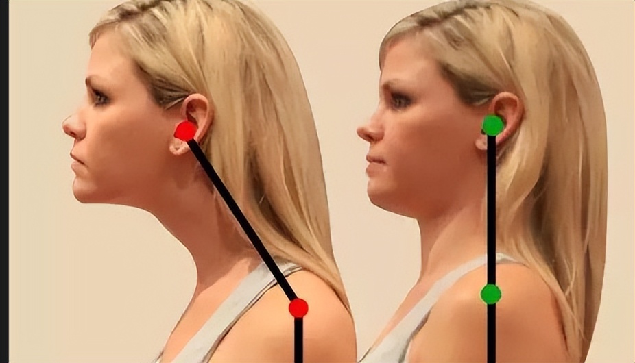 肩膀疼胳膊抬不起来按摩哪个穴位,睡觉起来肩膀疼可以按摩缓解吗