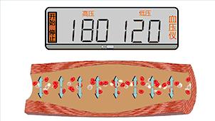 做胃镜检查选无痛还是普通的呢,胃镜检查做无痛的好还是普通的好