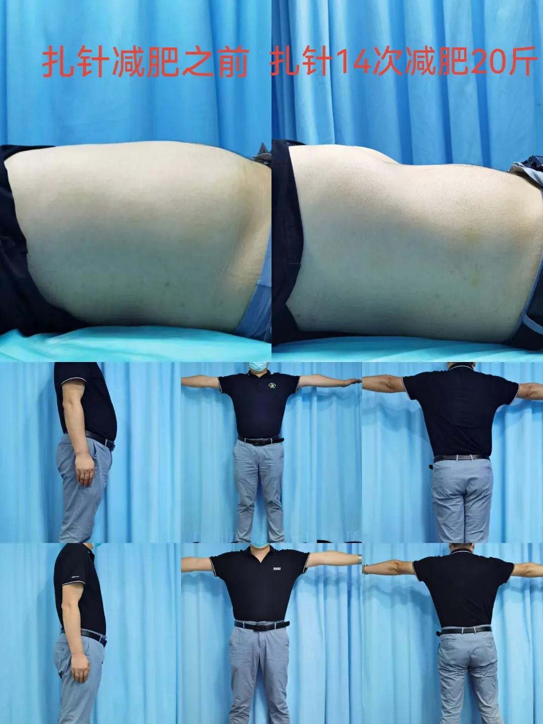 中医可以看经络吗,中医治疗经络多久有反应