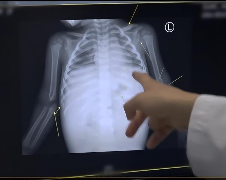 韩国最惨的虐童案件,最惨虐童案韩国