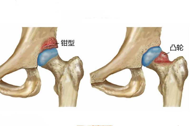 少年臀部疼痛什么原因,臀部疼痛怎么判断是什么病