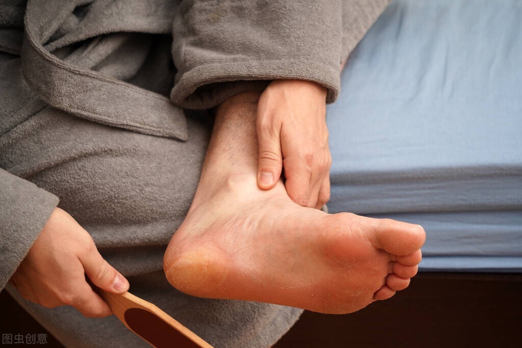 脚干裂润肤霜,脚心起皮干裂用什么药膏