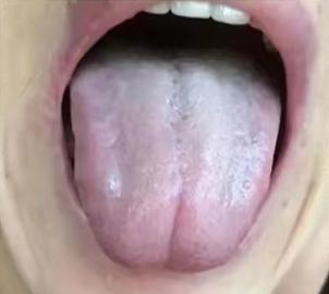 肥胖的类型及如何减肥,5种肥胖类型最佳减肥方案