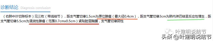 中叶多发微小结节,男性30岁右侧甲状腺单发结节