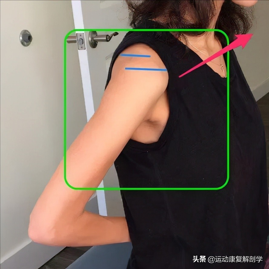 肩袖肌群之——肩胛下肌的不同角度训练