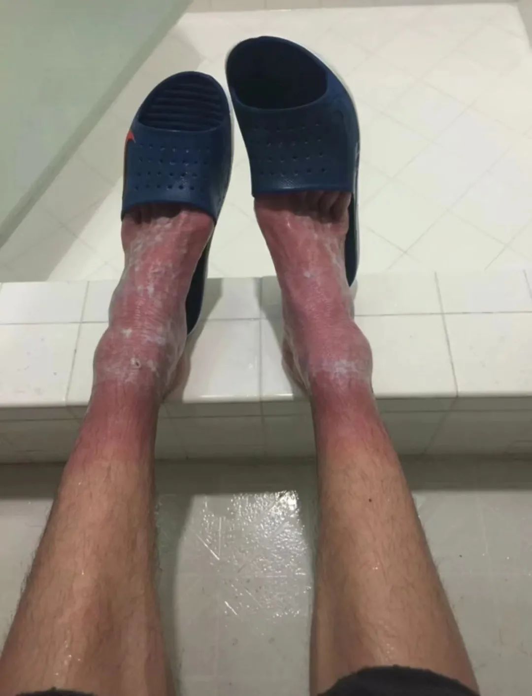 张国伟自愈的视频,张国伟最好成绩