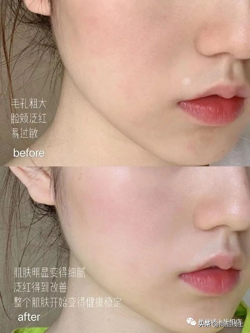 双11润百颜玻尿酸活动,润百颜紧致玻尿酸优惠券