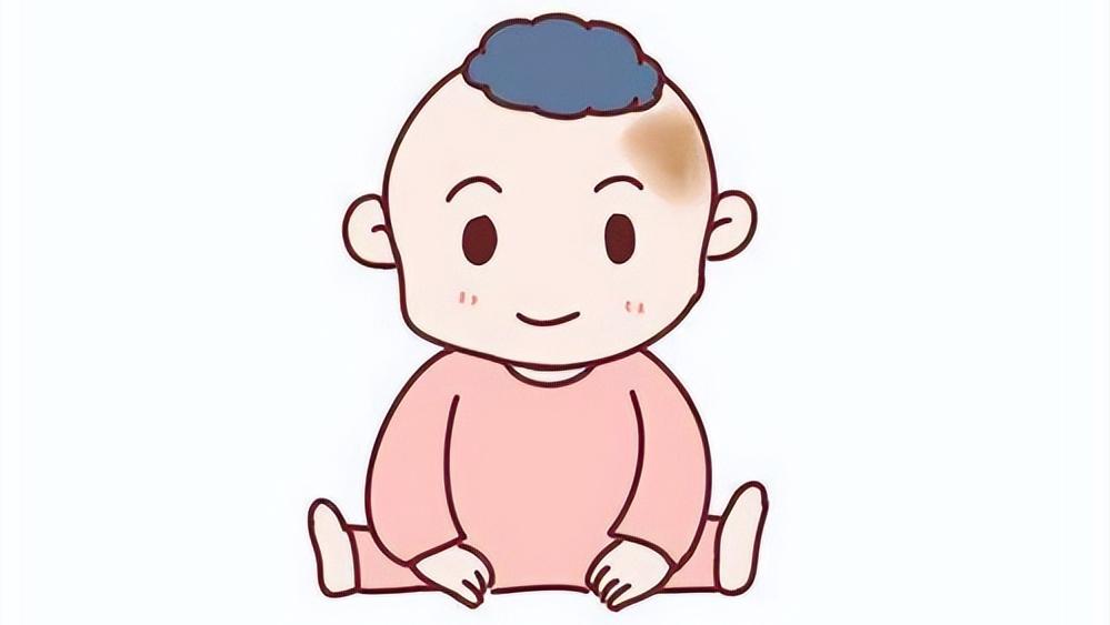 血管瘤最好根治办法,血管瘤最难治的是怎么样的