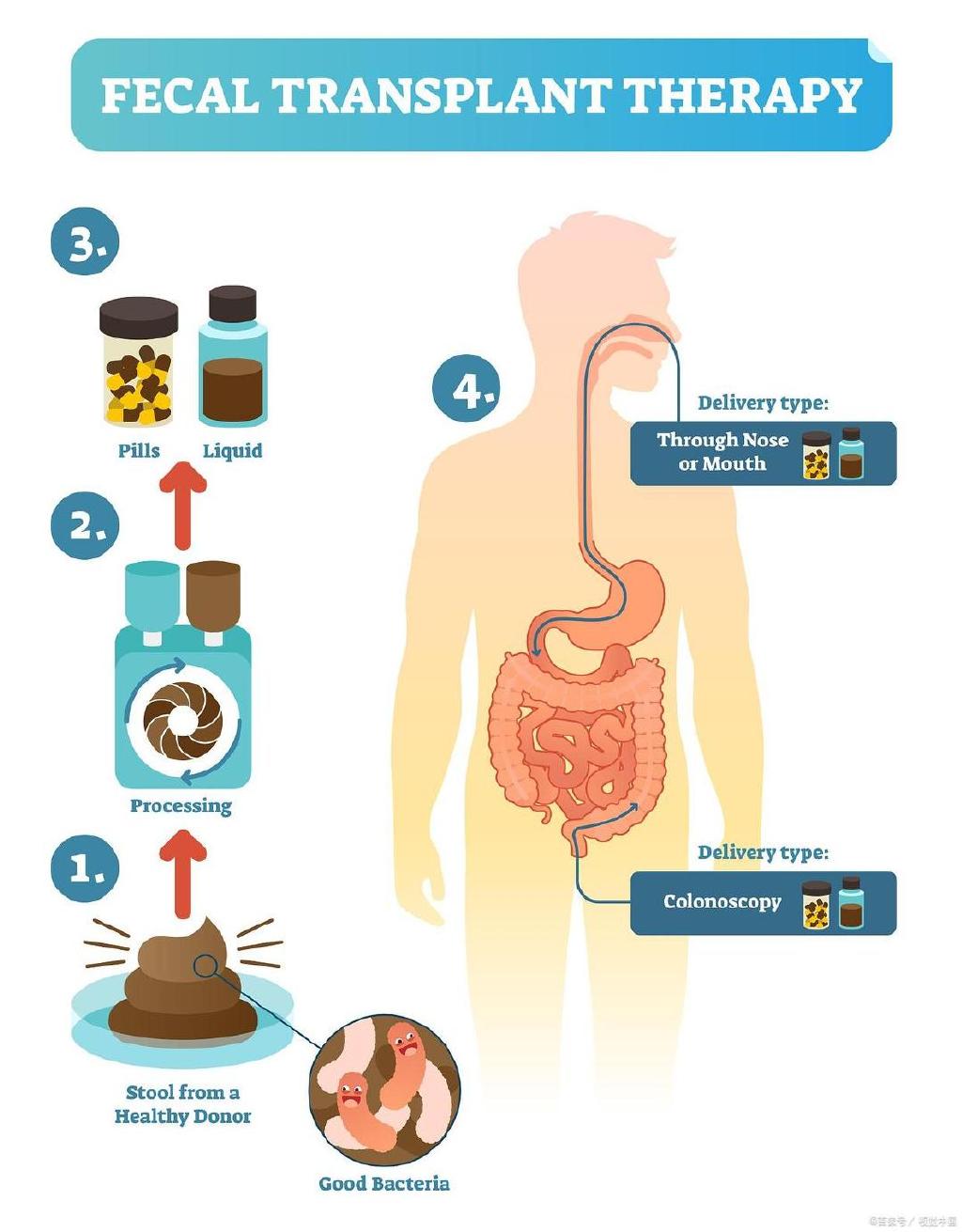 粪菌移植案例：不仅逆转2型糖尿病，类风湿性关节炎也有好转