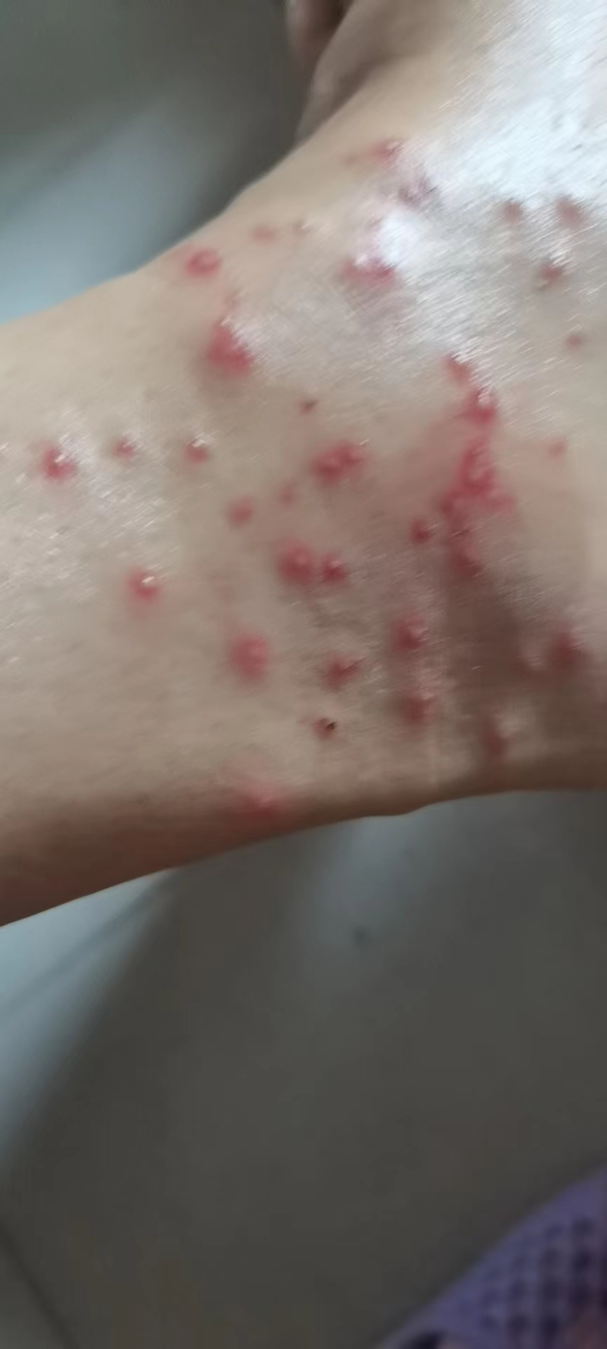 今天做了两件事重点喷杀蚂蚁窝