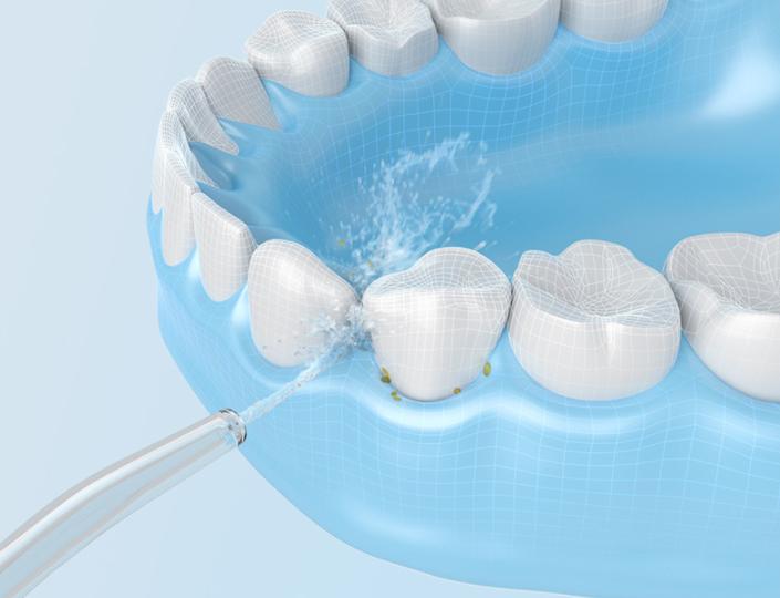 新年春节送父母长辈礼物怎么选？多款冲牙器成热门首选！