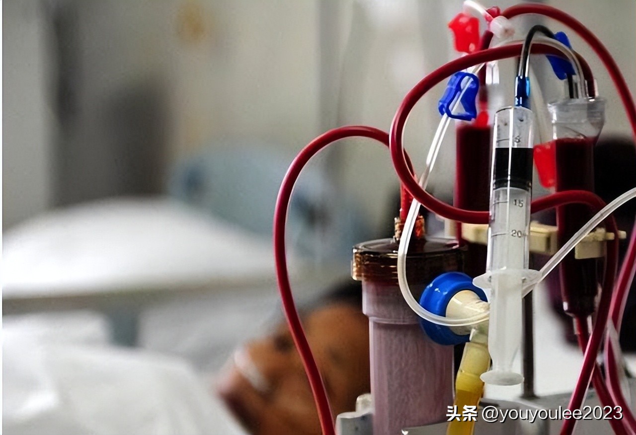 肾衰竭有这5个征兆有什么危险,肾衰竭突然不来月经