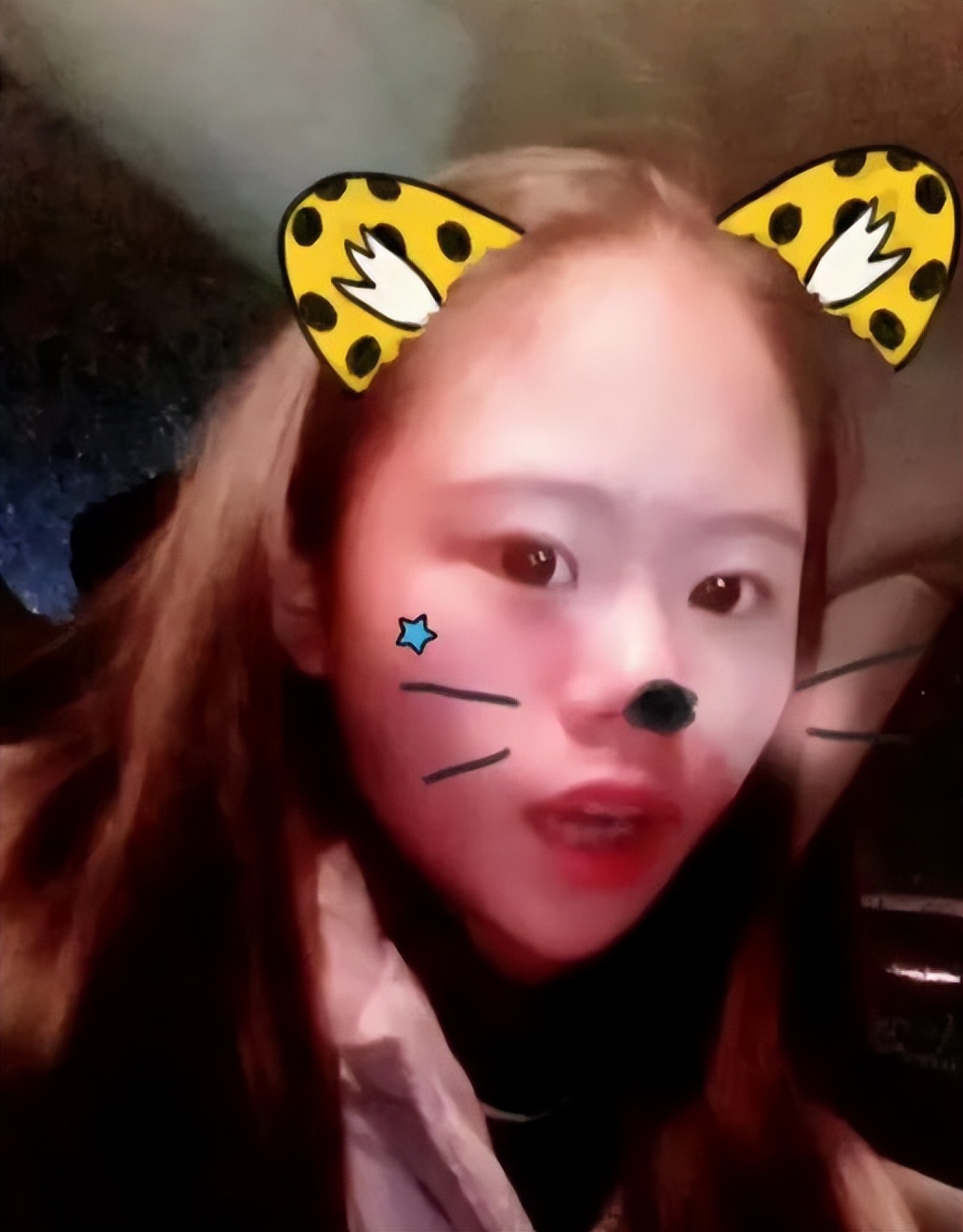 整容狂人整容100多次,整容狂魔手术200次